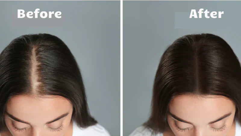 Zařízení Light Wave s červeným světlem pro růst vlasů pomáhá při řídnutí vlasů