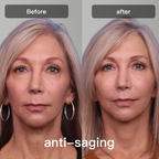 جهاز علاج بالضوء LED | جهاز علاج بالضوء LED بسبعة أطوال موجية للوجه والجسم