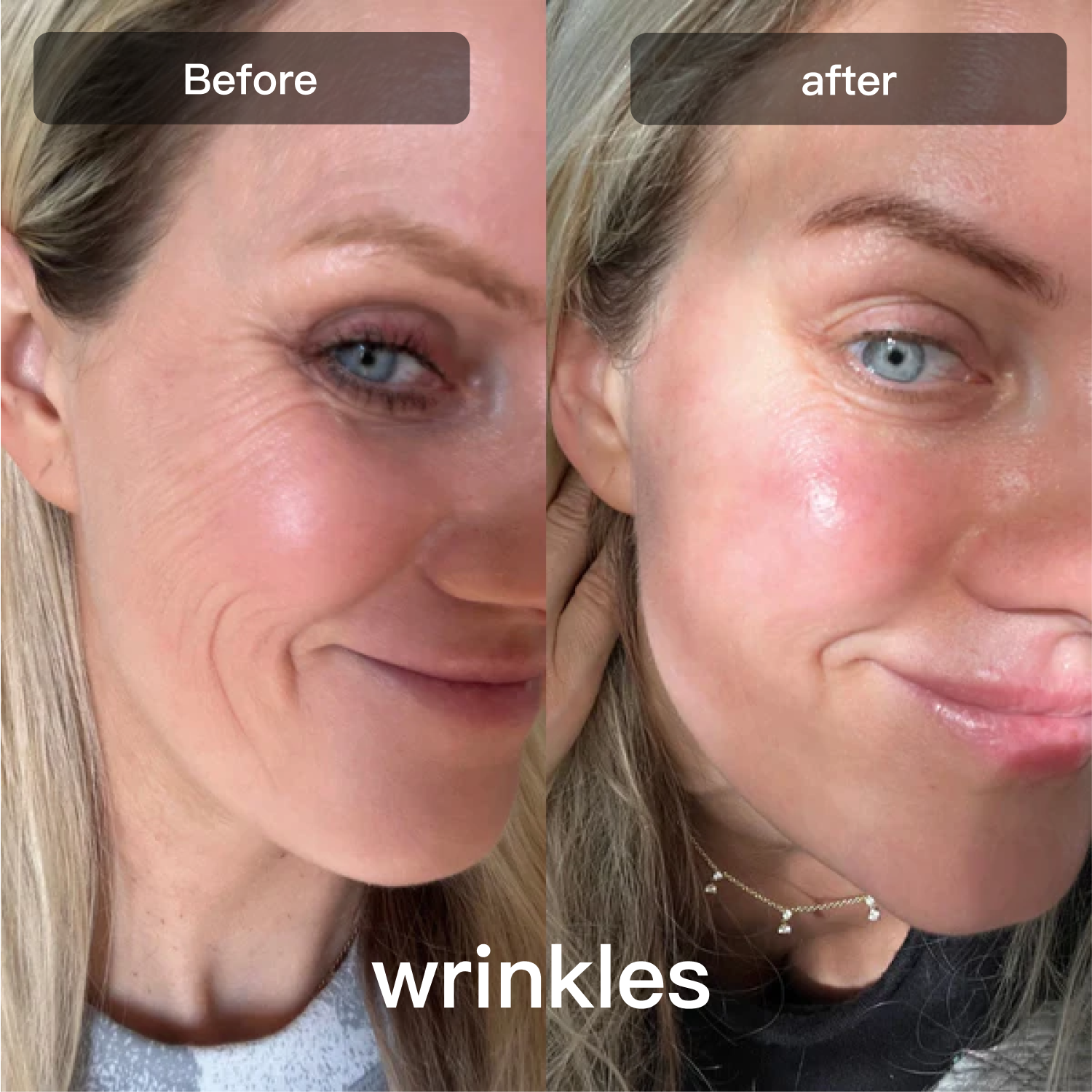 جهاز علاج بالضوء LED | جهاز علاج بالضوء LED بسبعة أطوال موجية للوجه والجسم