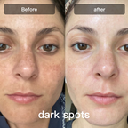 جهاز علاج بالضوء LED | جهاز علاج بالضوء LED بسبعة أطوال موجية للوجه والجسم