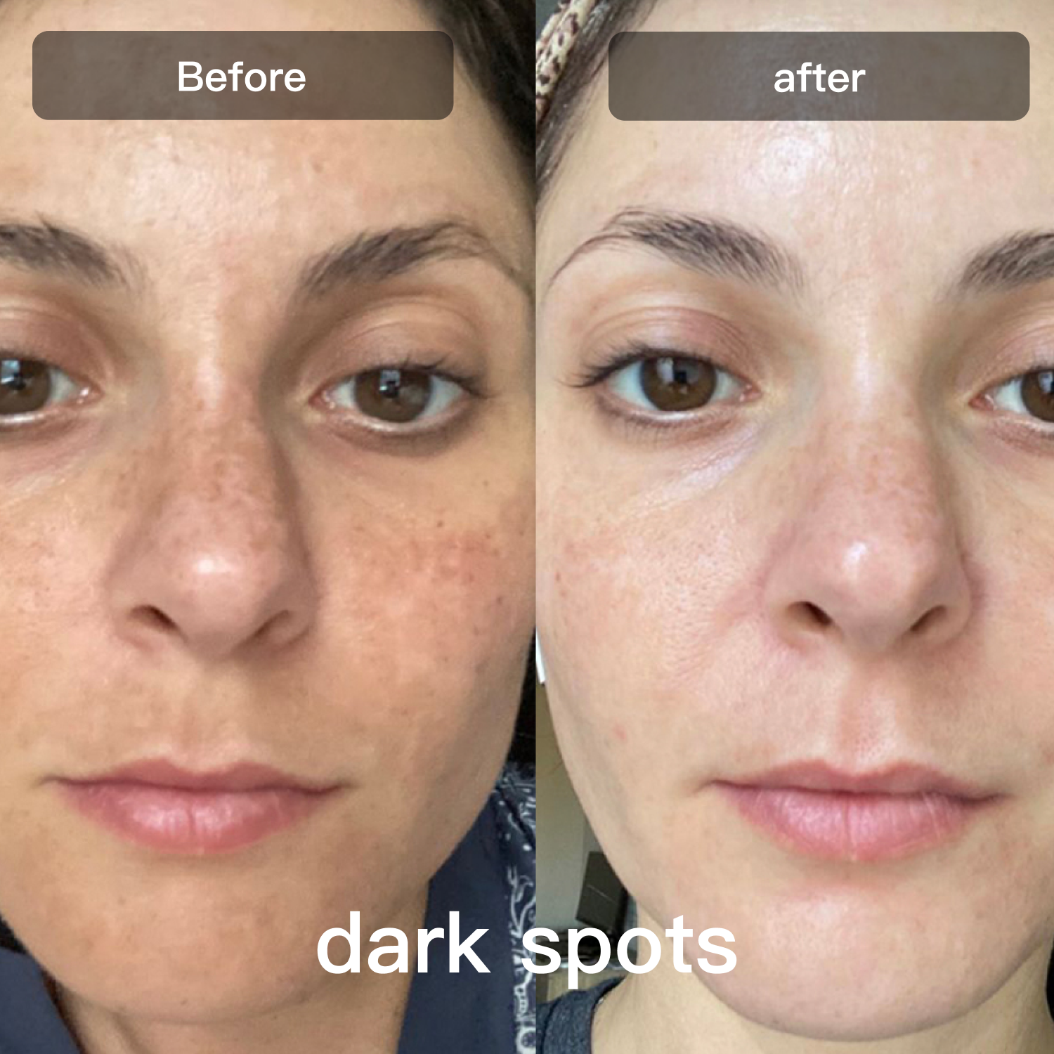 جهاز علاج بالضوء LED | جهاز علاج بالضوء LED بسبعة أطوال موجية للوجه والجسم