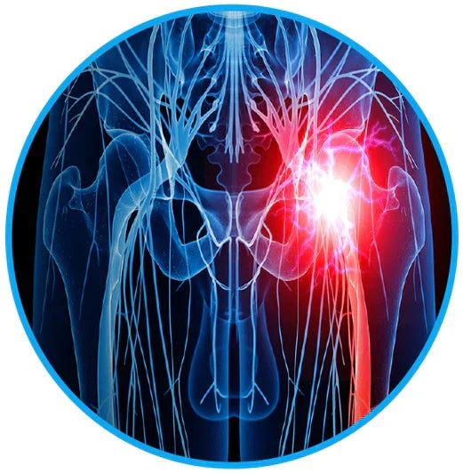 Sciatica Relief Belt for Back & Hip Pain | petprovac