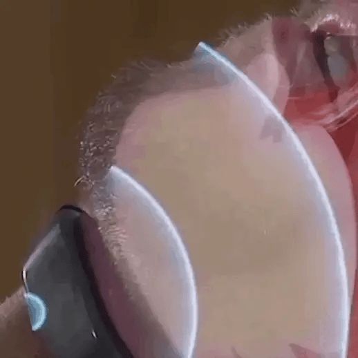 LumaWhisper Přenosná USB tichá pomůcka proti chrápání na spaní