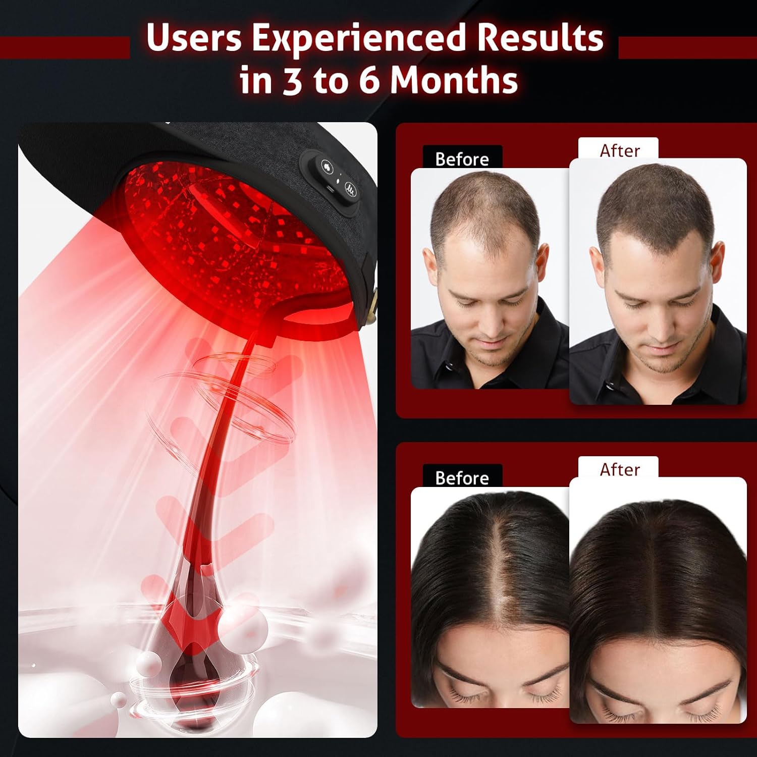 Wireless Laser Cap for Hair Regrowth – Red Light Therapy