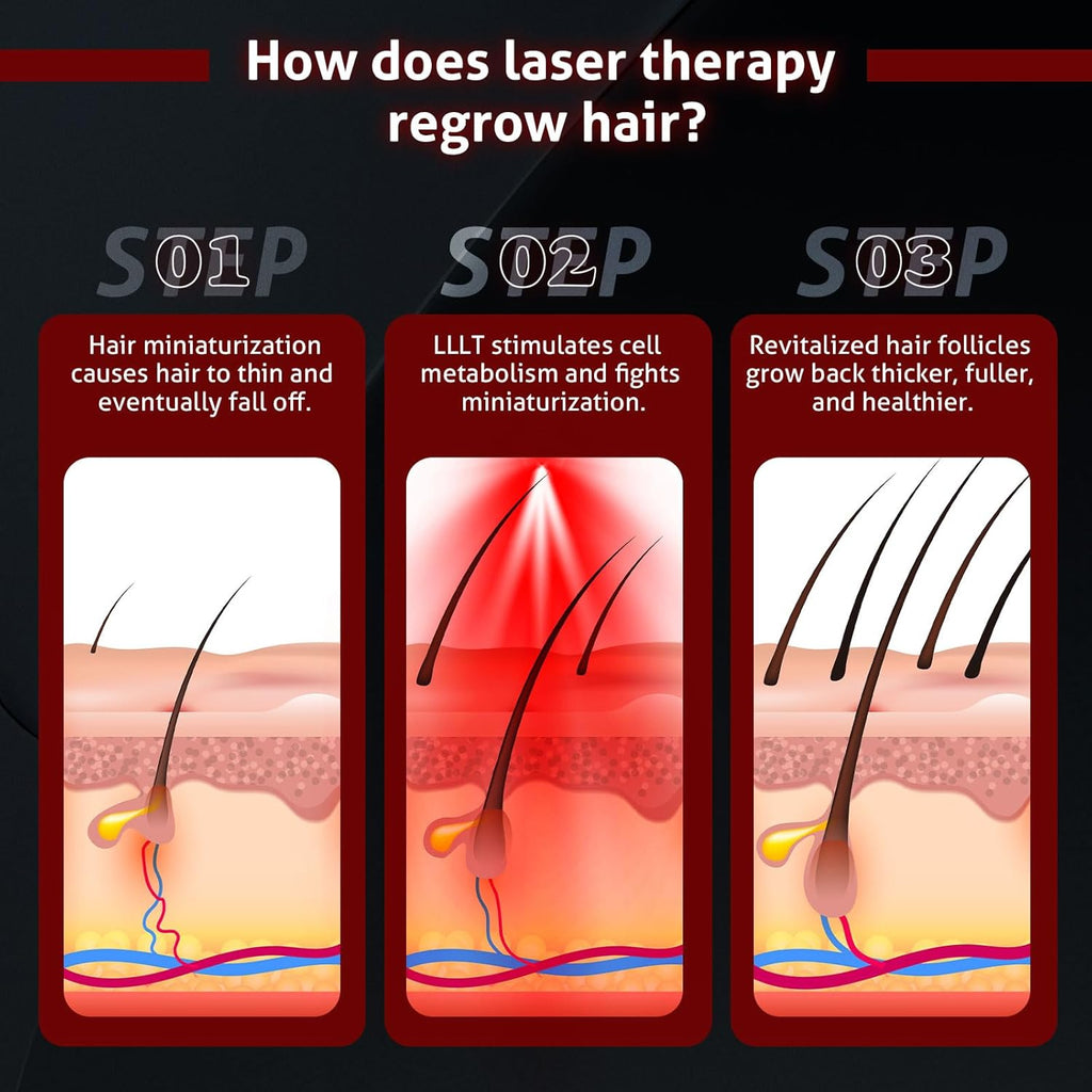 Wireless Laser Cap for Hair Regrowth – Red Light Therapy
