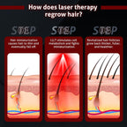 Wireless Laser Cap for Hair Regrowth – Red Light Therapy