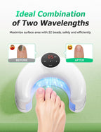 Kabelloses Dual-Lichttherapiegerät für Nagelverfärbungen und tägliches Wohlbefinden