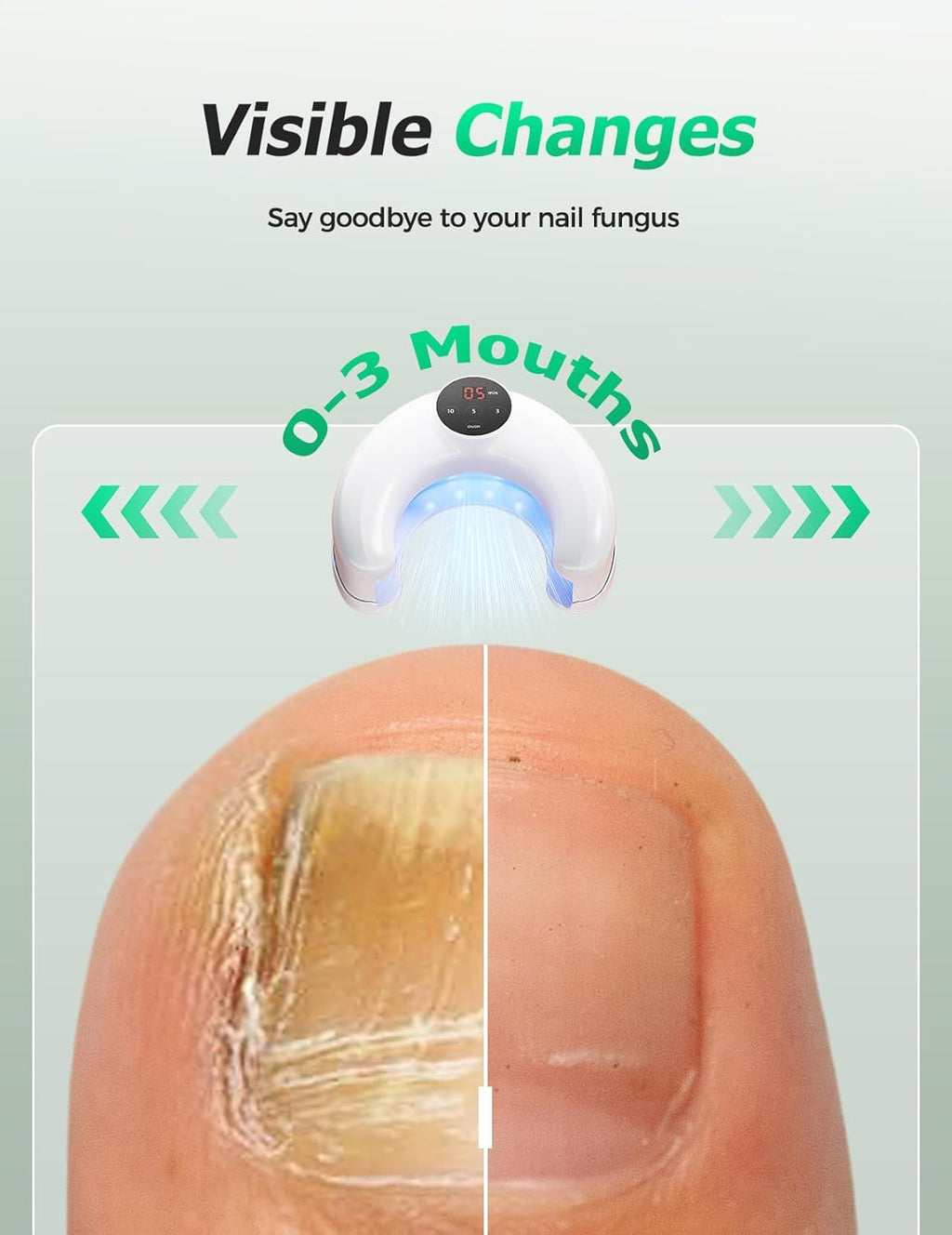 Kabelloses Dual-Lichttherapiegerät für Nagelverfärbungen und tägliches Wohlbefinden