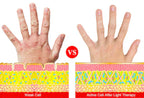Arthritis Hand Glove With Red Light For Pain Relief At Home